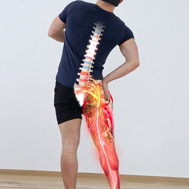 Sciatica Pain Treatment